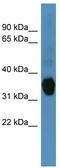 Aldo-keto reductase family 1 member C1 antibody, TA342867, Origene, Western Blot image 
