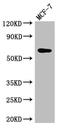 SYK antibody, A64076-100, Epigentek, Western Blot image 
