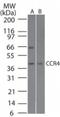 C-C chemokine receptor type 4 antibody, GTX53474, GeneTex, Western Blot image 