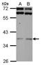 DnaJ Heat Shock Protein Family (Hsp40) Member B7 antibody, NBP2-16194, Novus Biologicals, Western Blot image 