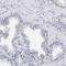 Outer dense fiber protein 2 antibody, HPA001874, Atlas Antibodies, Immunohistochemistry frozen image 