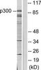 E1A Binding Protein P300 antibody, TA313820, Origene, Western Blot image 