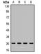 Mitochondrially Encoded Cytochrome C Oxidase II antibody, LS-C668487, Lifespan Biosciences, Western Blot image 
