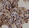 NCOR2 antibody, FNab10069, FineTest, Immunohistochemistry paraffin image 