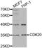 Cyclin Dependent Kinase 20 antibody, orb136820, Biorbyt, Western Blot image 