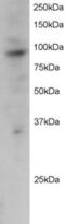 PML antibody, PA5-17963, Invitrogen Antibodies, Western Blot image 