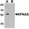 Karyopherin Subunit Alpha 6 antibody, TA326616, Origene, Western Blot image 