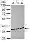 Leucine Rich Repeat Containing 59 antibody, PA5-32057, Invitrogen Antibodies, Western Blot image 