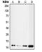 Ubiquitin Conjugating Enzyme E2 D2 antibody, MBS820197, MyBioSource, Western Blot image 