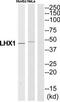 LIM/homeobox protein Lhx1 antibody, TA312851, Origene, Western Blot image 