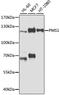 PMS1 Homolog 1, Mismatch Repair System Component antibody, A2183, ABclonal Technology, Western Blot image 