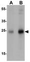Shisa Family Member 4 antibody, GTX32110, GeneTex, Western Blot image 