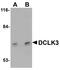 Doublecortin Like Kinase 3 antibody, A15882-1, Boster Biological Technology, Western Blot image 
