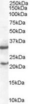 Suppressor Of Cytokine Signaling 1 antibody, EB05040, Everest Biotech, Western Blot image 
