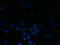 Dehydrogenase/Reductase 3 antibody, A62410-100, Epigentek, Immunofluorescence image 