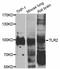 Toll Like Receptor 2 antibody, A11225, ABclonal Technology, Western Blot image 