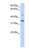 Ceroid-lipofuscinosis neuronal protein 6 antibody, NBP1-59415, Novus Biologicals, Western Blot image 