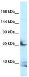 Follistatin Like 4 antibody, TA343245, Origene, Western Blot image 
