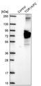 Torsin 1A Interacting Protein 2 antibody, PA5-62500, Invitrogen Antibodies, Western Blot image 