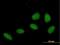 Zinc Finger Protein 549 antibody, H00256051-B01P, Novus Biologicals, Immunofluorescence image 