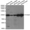 Integrin Subunit Alpha 2b antibody, TA332837, Origene, Western Blot image 