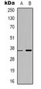 Zinc Finger RANBP2-Type Containing 2 antibody, LS-C368650, Lifespan Biosciences, Western Blot image 