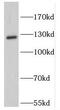 Kinesin-like protein KIF11 antibody, FNab02665, FineTest, Western Blot image 