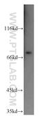 Sterile Alpha Motif Domain Containing 4A antibody, 17387-1-AP, Proteintech Group, Western Blot image 