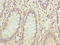Zinc Finger Protein 544 antibody, LS-C676757, Lifespan Biosciences, Immunohistochemistry paraffin image 