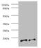 Prefoldin Subunit 5 antibody, A51557-100, Epigentek, Western Blot image 