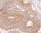 La Ribonucleoprotein Domain Family Member 1 antibody, A302-087A, Bethyl Labs, Immunohistochemistry paraffin image 