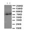 ATP Binding Cassette Subfamily D Member 3 antibody, orb137894, Biorbyt, Western Blot image 