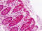 Cytoplasmic Linker Associated Protein 2 antibody, MBS248229, MyBioSource, Immunohistochemistry paraffin image 