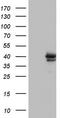 Core histone macro-H2A.2 antibody, TA803459AM, Origene, Western Blot image 