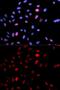 Structural Maintenance Of Chromosomes 1A antibody, GTX55474, GeneTex, Immunofluorescence image 