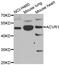 Activin A Receptor Type 1 antibody, abx007020, Abbexa, Western Blot image 
