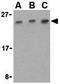 C1q And TNF Related 7 antibody, GTX85502, GeneTex, Western Blot image 