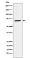 Leukotriene A4 Hydrolase antibody, M02399-3, Boster Biological Technology, Western Blot image 