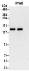 Tubulin Tyrosine Ligase Like 5 antibody, NBP2-32086, Novus Biologicals, Immunoprecipitation image 