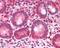 Bromodomain Adjacent To Zinc Finger Domain 2B antibody, orb18883, Biorbyt, Immunohistochemistry paraffin image 