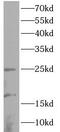 LIM Domain Only 2 antibody, FNab10022, FineTest, Western Blot image 