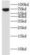 Kelch repeat and BTB domain-containing protein 10 antibody, FNab04474, FineTest, Western Blot image 