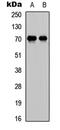 E2F-1 antibody, abx121474, Abbexa, Western Blot image 