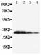 Kallikrein-1 antibody, PA5-79563, Invitrogen Antibodies, Western Blot image 