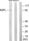 6-phosphofructokinase, liver type antibody, LS-C118803, Lifespan Biosciences, Western Blot image 
