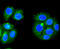 5-aminolevulinate synthase, nonspecific, mitochondrial antibody, 13-922, ProSci, Immunofluorescence image 
