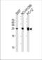 Ubiquitin carboxyl-terminal hydrolase isozyme L1 antibody, TA324990, Origene, Western Blot image 