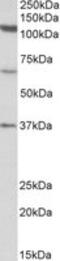 Centrosomal protein CP110 antibody, MBS423182, MyBioSource, Western Blot image 