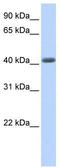 Leucine Rich Repeat Containing 2 antibody, TA329471, Origene, Western Blot image 