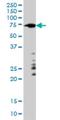 A-Raf Proto-Oncogene, Serine/Threonine Kinase antibody, H00000369-M01, Novus Biologicals, Western Blot image 